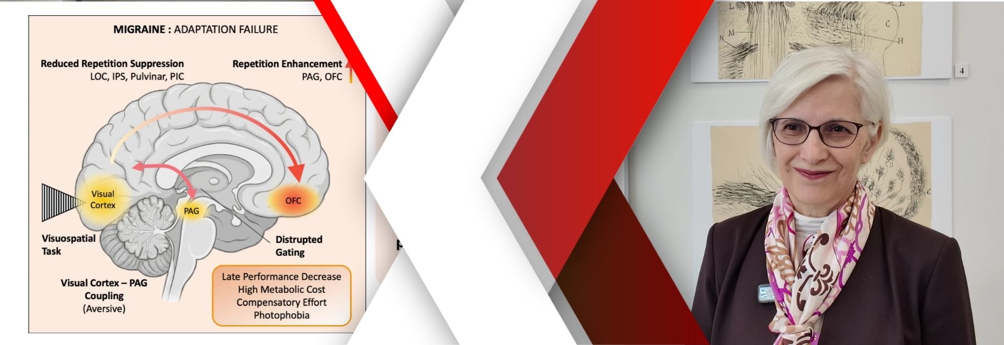 NÖROM: Migraine Brain Cannot Filter “Irrelevant”; Light and Patterns Trigger Pain